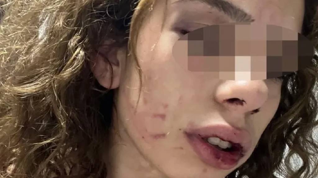 Konya'da 19 yaşındaki kızı darp eden gencin savunması: “Kendi kendini yaraladı”