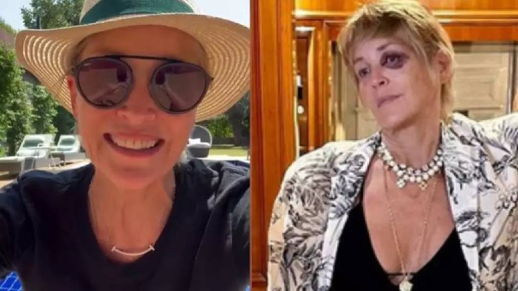 Ünlü oyuncu Sharon Stone, Bodrum'da kaza geçirdi