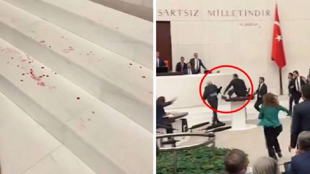 Meclis'te utandıran görüntüler! DEM Parti'li Gülistan Kılıç Koçyiğit'in kaşı yarıldı...
