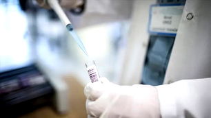 Maymun Çiçeği virüsünde yeni varyantlar tespit edildi