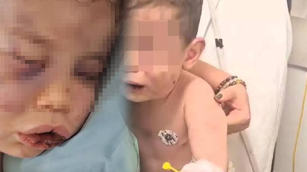 Denizli’de vicdanları sarsan vahşet! 2 yaşındaki bebek öldüresiye darp edildi...
