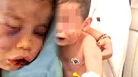 Denizli’de vicdanları sarsan vahşet! 2 yaşındaki bebek öldüresiye darp edildi...