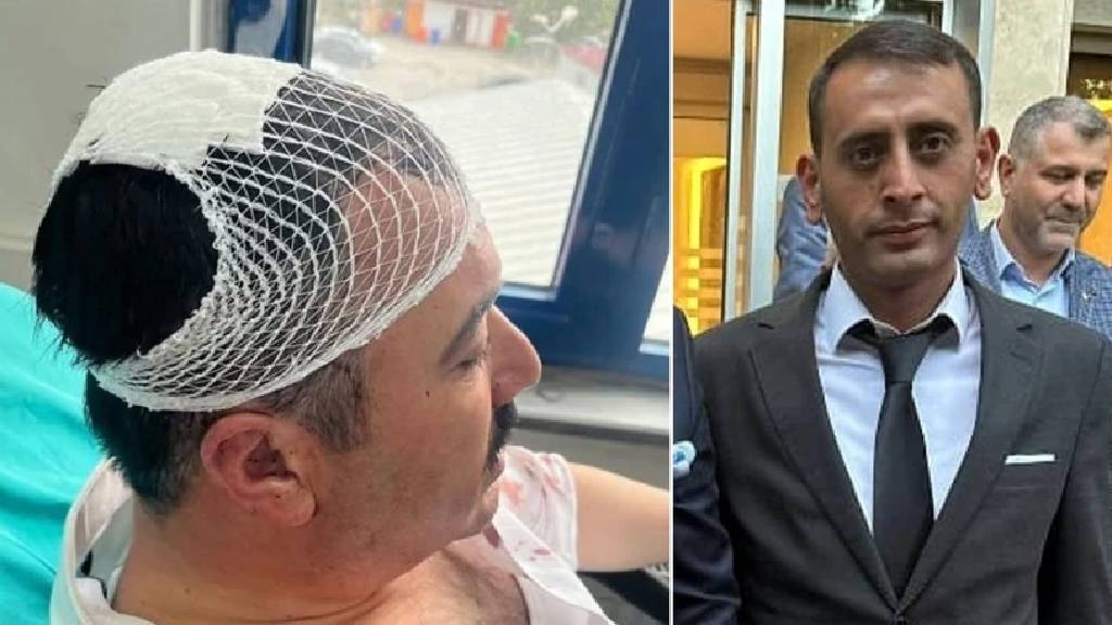 Şekerlikle belediye başkan yardımcısını yaralamıştı! YRP'li yönetici tutuklandı...