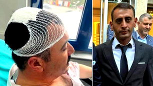 Şekerlikle belediye başkan yardımcısını yaralamıştı! YRP'li yönetici tutuklandı...
