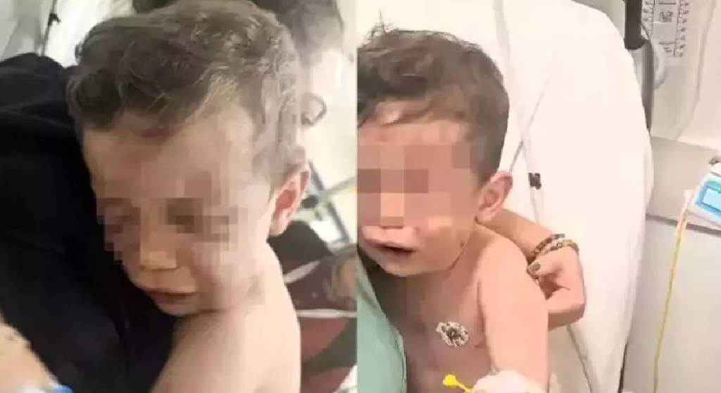 Caniler gözaltında! Devlet korumasına alınan Aren bebek, ameliyat edilecek…