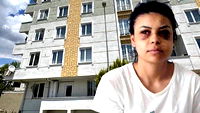 Düğünde maganda dehşeti! Saçmalar, gözüne isabet etti…