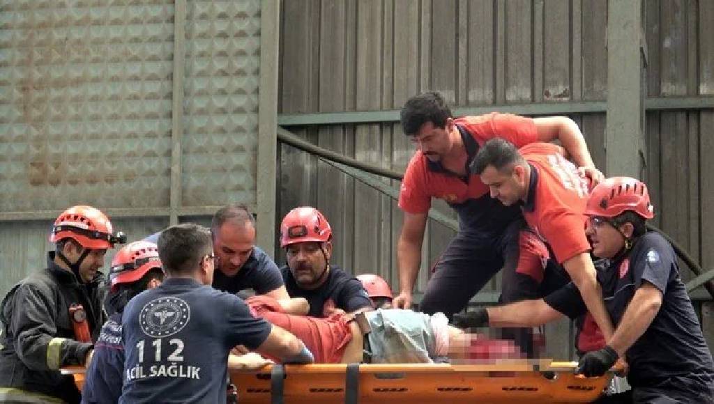 Plastik fabrikasında korkunç kaza: İşçinin bacakları koptu