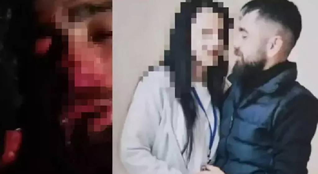 Ankara'da inanılmaz olay! ‘Burnunu yedim, kulağını da çiğ çiğ yiyeceğim’