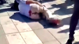 Gaziantep'te polis ekibine ateş açıldı: 4 yaralı 