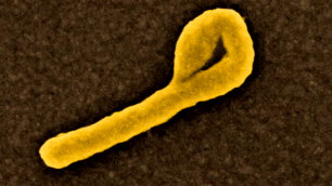 Nijerya, Kenya'daki vakanın ardından Ebola riskine karşı uyardı