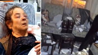 Kayseri'de evinde otururken üzerine tavan çöktü