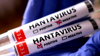 Hantavirüs açıklaması: "Türkiye'de yok"
