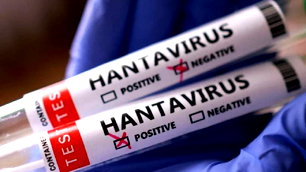 Hantavirüs açıklaması: "Türkiye'de yok"